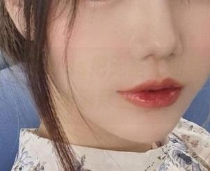 不得不说，洛可ss把无圣光的夏日演绎得淋漓尽致。